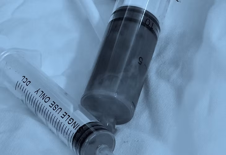 Dịch mủ hút ra từ khối áp xe tuỵ do hóc xương cá. Ảnh: BVCC.