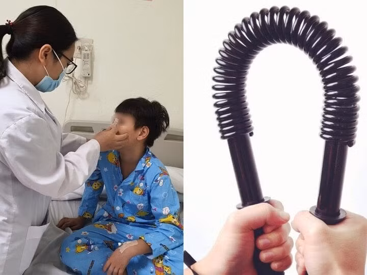 Xem bạn bẻ "đồ long đao", bé trai bị đập gãy xương mũi.