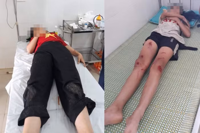 Xe đạp điện lao xuống suối, ba học sinh lớp 7 thương vong 1