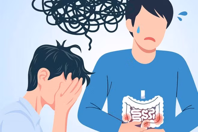 Ảnh hưởng của căng thẳng đến triệu chứng bệnh viêm ruột. Đồ họa: Thiện Nhân