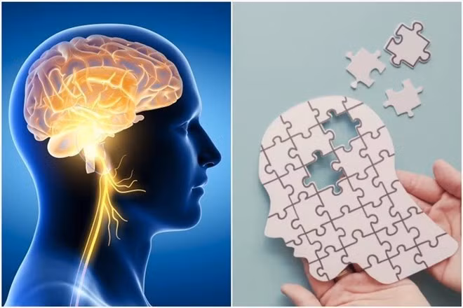 Thực hiện các biện pháp cải thiện não bộ như ngủ đủ giấc, tập thể dục, dinh dưỡng hợp lý và tĩnh lặng giúp nâng cao sức khỏe não và ngăn suy giảm trí nhớ. Đồ họa: Thanh Thanh