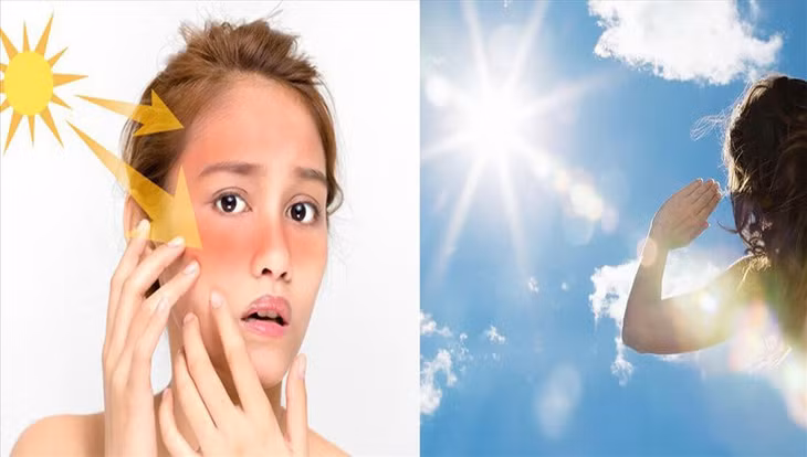 Những bí kíp bỏ túi cho chị em có da nhạy cảm tránh khỏi ánh nắng mặt trời.