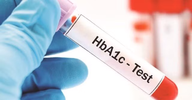 Xét nghiệm hemoglobin A1c (HbA1C) nằm trong khoảng 5,7% đến 6,4 % được xem là tiền đái tháo đường.