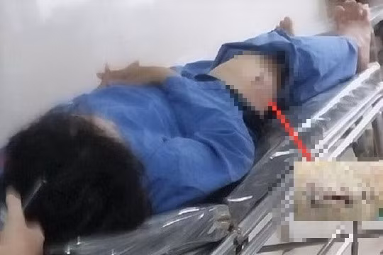 Nạn nhân thời điểm cấp cứu tại bệnh viện với vết thương ở đùi.