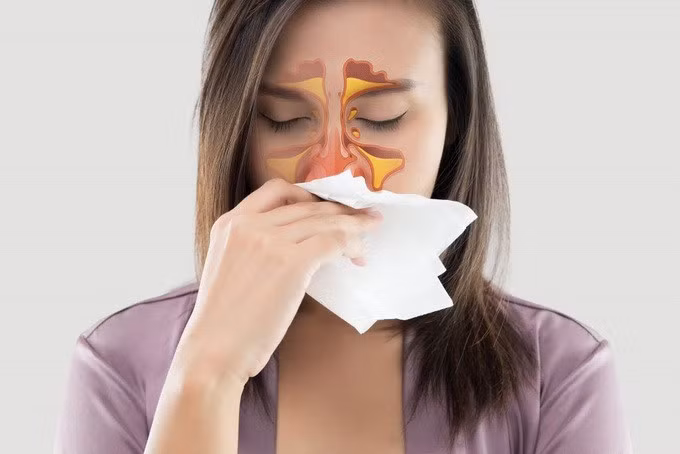 Cần xác định nguyên nhân gây ngạt mũi để có hướng xử trí phù hợp (Ảnh minh họa: Shutterstock).