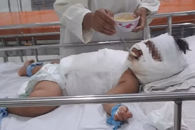 Sau 4 ngày điều trị, sức khỏe bệnh nhi đã ổn định hơn, có thể ăn uống được (Ảnh: CTV).