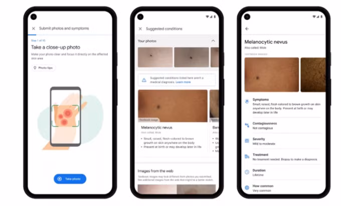 Công cụ AI chẩn đoán da liễu bằng hình ảnh thường được Google ra mắt cuối năm nay. Ảnh: Google.