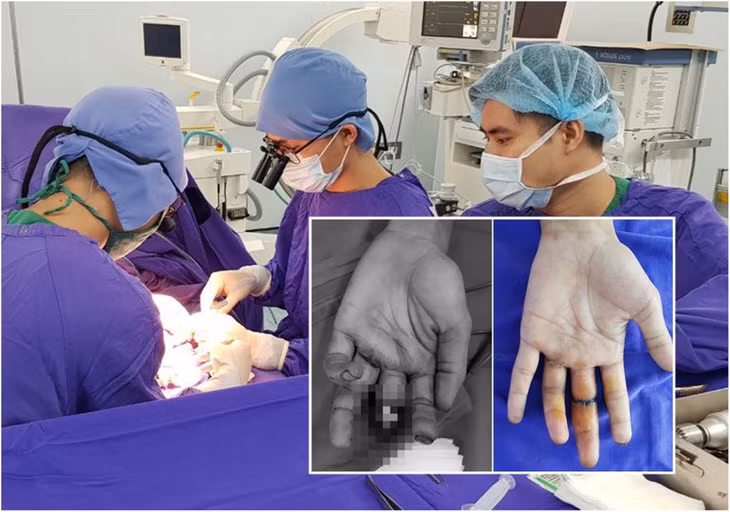 Kíp bác sĩ khoa Chấn thương chỉnh hình thực hiện ca vi phẫu nối chi phức tạp.