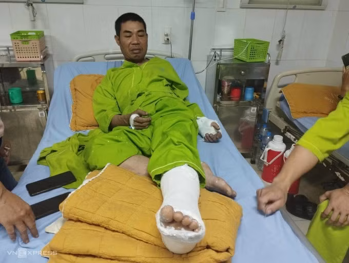 Nạn nhân Long đang điều trị tại Bệnh viện Đa khoa Yên Bái. Ảnh: Phạm Chiểu