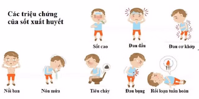 Các triệu chứng của bệnh sốt xuất huyết ở trẻ em.