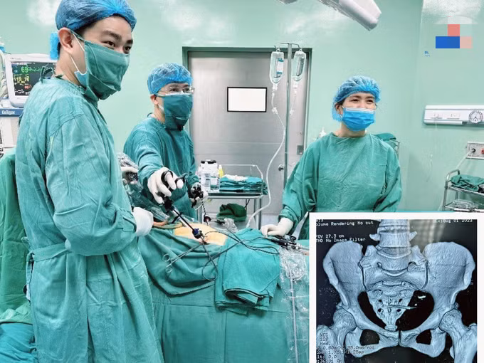 Các bác sĩ Bệnh viện Sản Nhi Nghệ An tiến hành phẫu thuật lấy dụng cụ tránh thai ra cho hai bệnh nhân (Ảnh: Hoàng Yến).