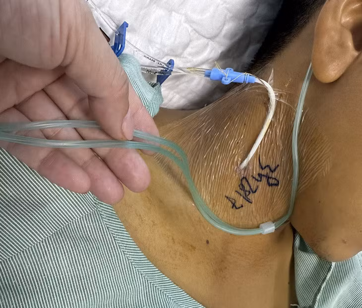 Bệnh nhân nhập viện trong tình trạng vàng da sau khi ăn xôi có màu tím - Ảnh: BVCC