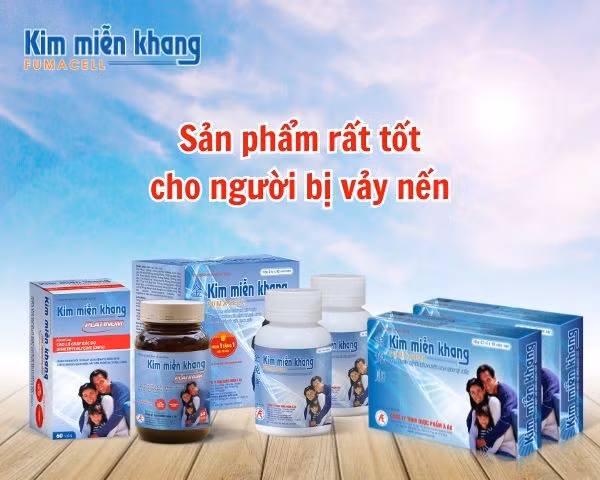 Kim Miễn Khang được nhiều người đánh giá cao về hiệu quả cải thiện bệnh vảy nến.