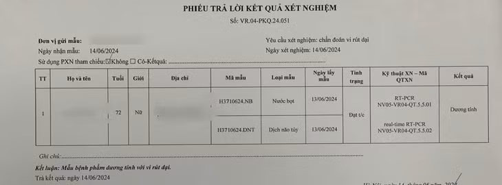Kết quả xét nghiệm cụ bà dương tính với virus dại.