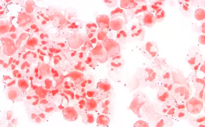 Vi khuẩn Neisseria meningitidis gây bệnh viêm não mô cầu. (Nguồn: Wikipedia)