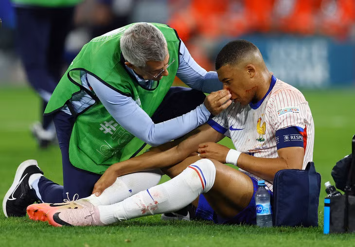 Mbappe không thể ra sân ở trận gặp Hà Lan vì chấn thương mũi - Ảnh: REUTERS