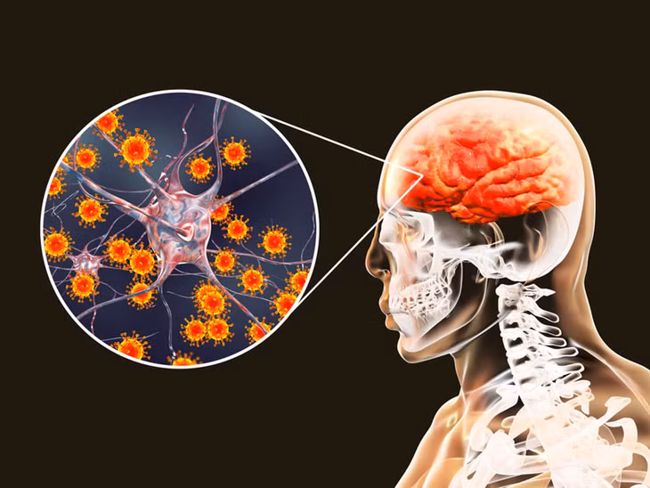 Virus viêm não Nhật Bản xâm nhập vào cơ thể con người qua vết đốt của muỗi truyền bệnh.