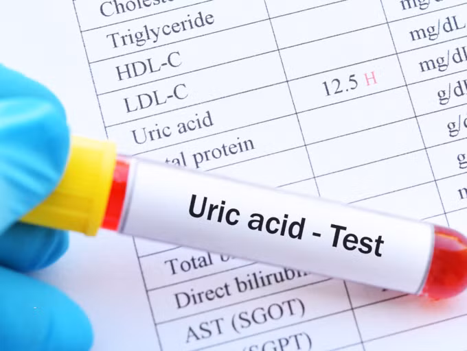 5 biện pháp giảm nồng độ axit uric hiệu quả- Ảnh 1.
