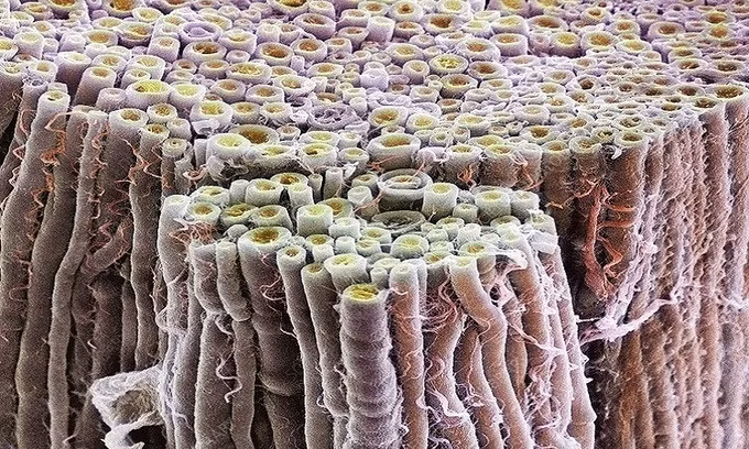 Mặt cắt bó sợi thần kinh nhìn dưới kính hiển vi điện tử quét. Ảnh: Science Photo Library