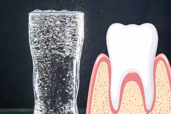 Nước khoáng có ga và nguy cơ bào mòn men răng. Đồ họa: Thiện Nhân