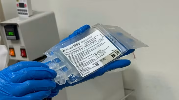 Túi tế bào Tisagenlecleucel trước khi truyền cho bệnh nhân - Ảnh: BVCC