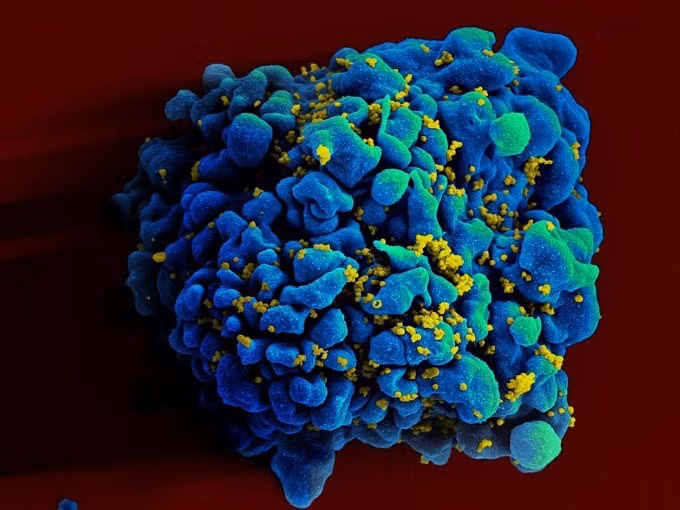 Hình ảnh hiển thị virus HIV đang xâm nhập vào tế bào T (tế bào miễn dịch). Ảnh: NIAID