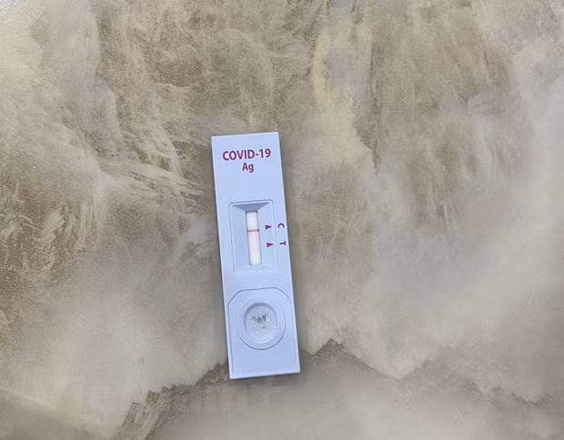 Co hien tuong dau co, tang gia bo sinh pham xet nghiem SARS-CoV-2 hinh anh 1