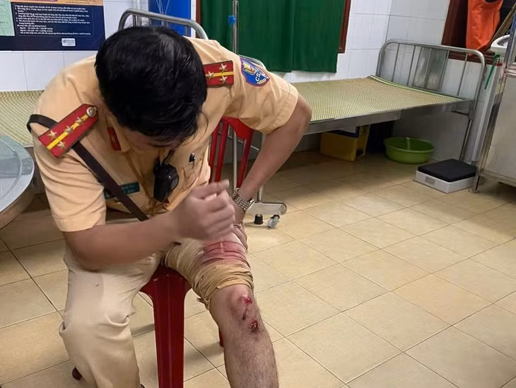 Chân Đại úy Phạm Bá Tĩnh bị thương trong quá trình truy đuổi, khống chế đối tượng.
