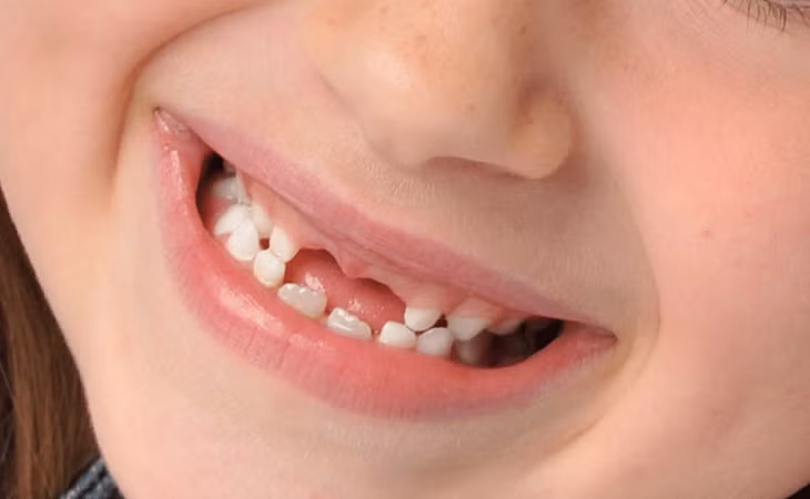 Chăm sóc răng từ sớm để góp phần bảo đảm sức khỏe - Ảnh: INQUIRER