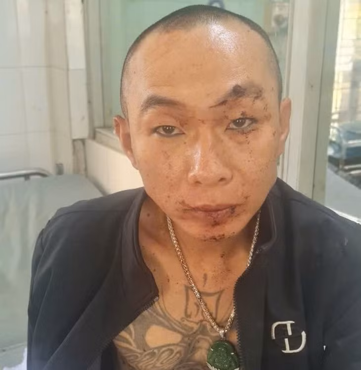 Đối tượng Lê Ngọc Trường bị bắt giữ. Ảnh: Công an