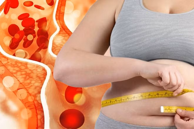 Cholesterol cao không trực tiếp gây tăng cân, nhưng các yếu tố lối sống dẫn đến cholesterol cao là những yếu tố góp phần gây tăng cân. Đồ hoạ: Thiện Nhân