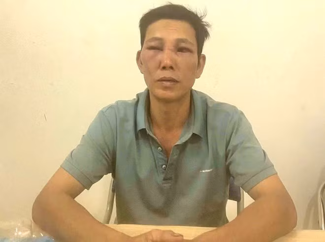 Đối tượng Nguyễn Hữu Kiên tại trụ sở cơ quan Công an sau khi chém trọng thương bạn nhậu. Ảnh: Công an cung cấp
