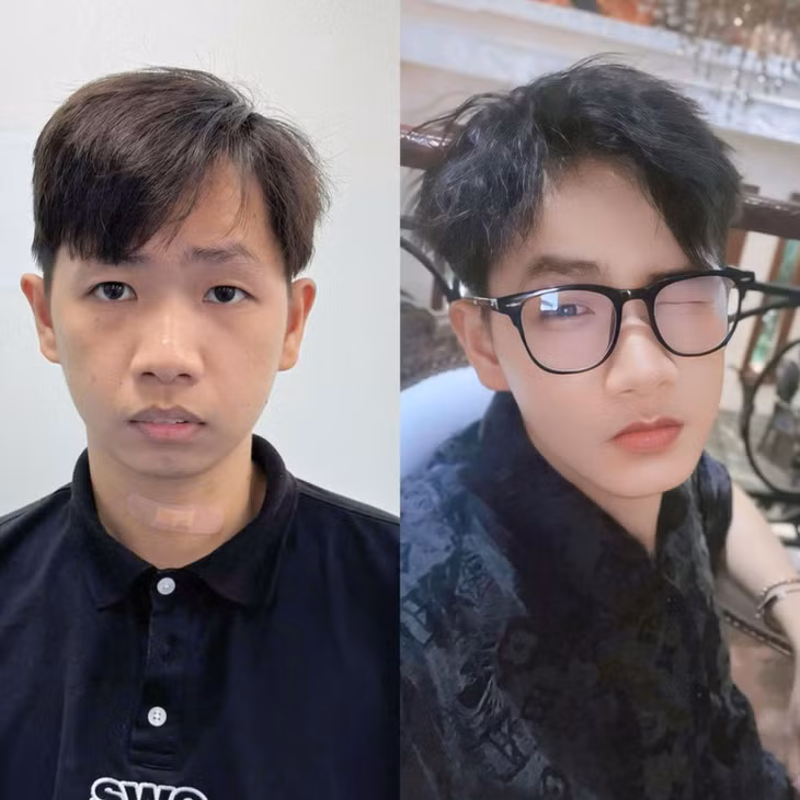Điển trai và tự tin hơn là những gì mọi người nhận xét về Thanh Duẩn.