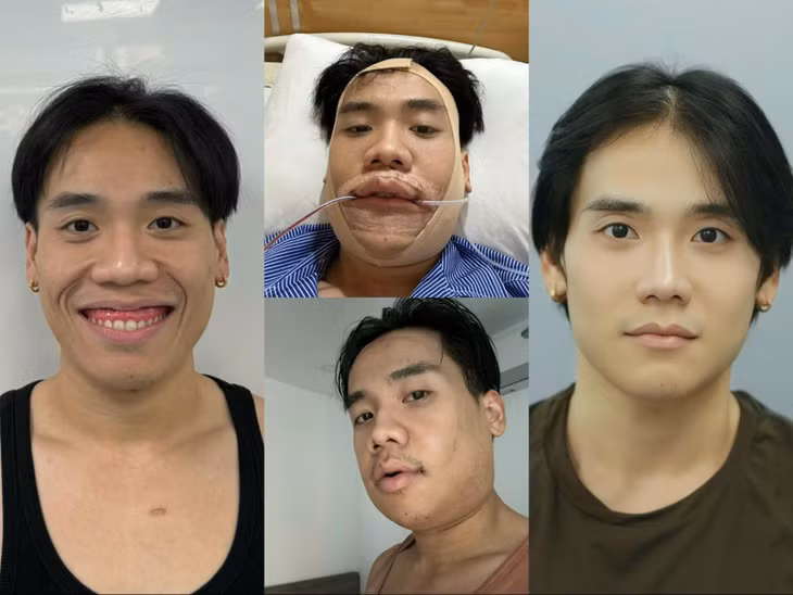 Sự thay đổi giúp Tiến có nhan sắc không thua kém các mỹ nam đời thật.