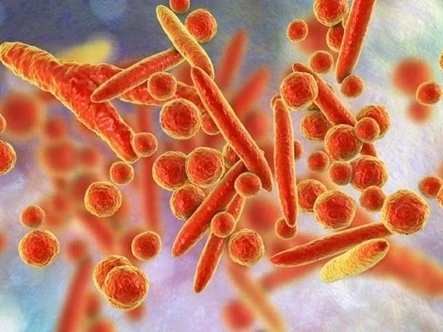 WHO bác thông tin về virus lạ gây triệu chứng ho ra máu ở Nga ảnh 1