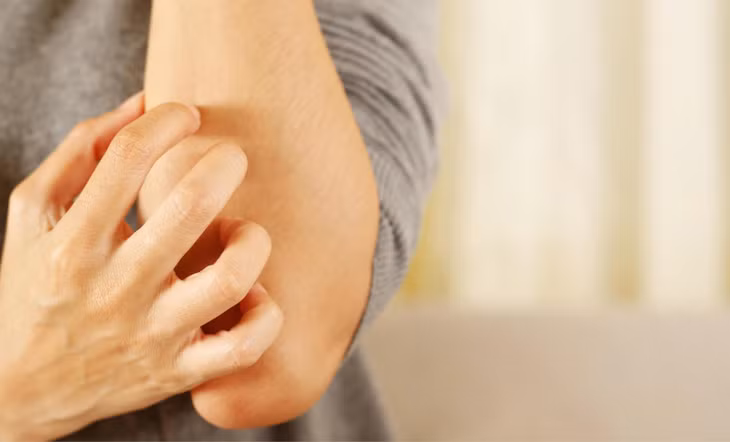 Mẩn ngứa kéo dài không rõ nguyên nhân có thể là tín hiệu gan đang kêu cứu ảnh 1