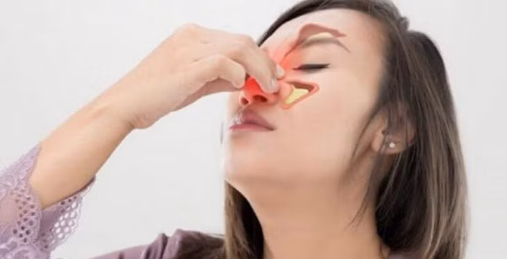 Viêm xoang dị ứng: Những lưu ý cần biết để điều trị kịp thời - Bệnh Viện Đa Khoa Quốc Tế Bắc Hà