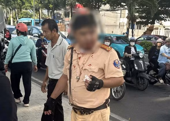 Lực lượng chức năng đã khống chế một người ngoại quốc khi người này có hành vi đấm vào mặt chiến sĩ CSGT ở Nha Trang. Ảnh: Hiếu Giang