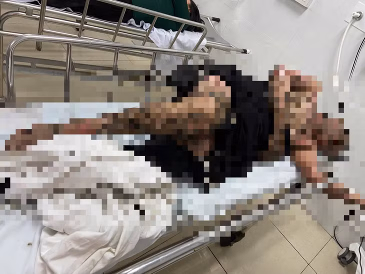 Người đàn ông bị điện giật khi câu cá, được đưa đi cấp cứu. Ảnh: Duy Tuấn