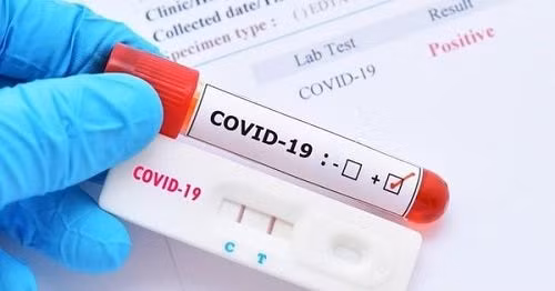 Miễn thuế nhập khẩu đối với vật tư để sản xuất que test COVID-19