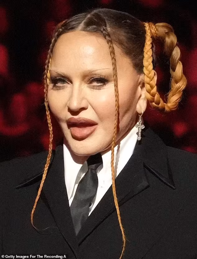 Nhan sắc thật của Madonna khiến cư dân mạng bàn tán. Ảnh: Getty Images.