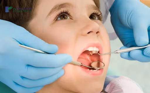 Trẻ em có trồng răng implant được không? ảnh 5