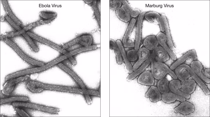 Virus Ebola và virus Marburg.