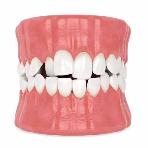 Trường hợp được bác sĩ khuyên là KHÔNG được chỉ định thực hiện