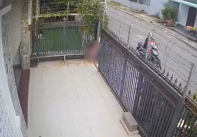 Bé gái 4 tuổi bị cửa cổng tự động chèn ép gần 5 phút dẫn tới hôn mê. Ảnh: Bệnh viện Quốc tế Hoàn Mỹ Đồng Nai cung cấp