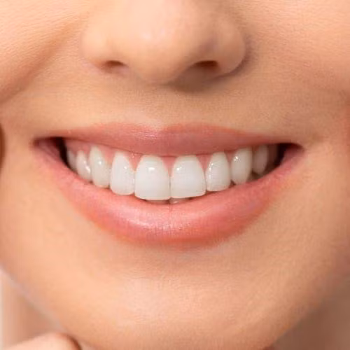 Giải đáp bọc răng sứ có tốt không?