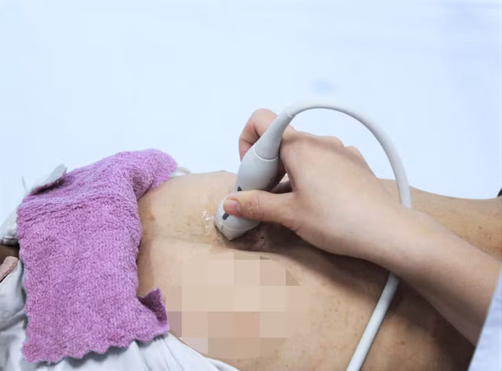 Trường hợp trẻ bị biến dạng lồng ngực được phát hiện qua khám sàng lọc.