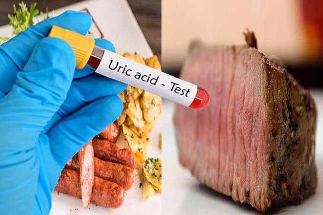 Người có axit uric cao cần lưu ý một số điều khi ăn thịt. Đồ hoạ: Hạ Mây