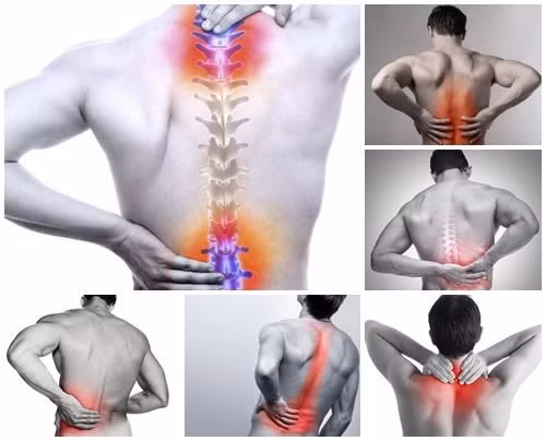 Thoái hóa cột sống gây ra những cơn đau nhức vùng lưng, cổ, vai gáy... làm ảnh hưởng đến khả năng lao động và chất lượng cuộc sống của người bệnh.