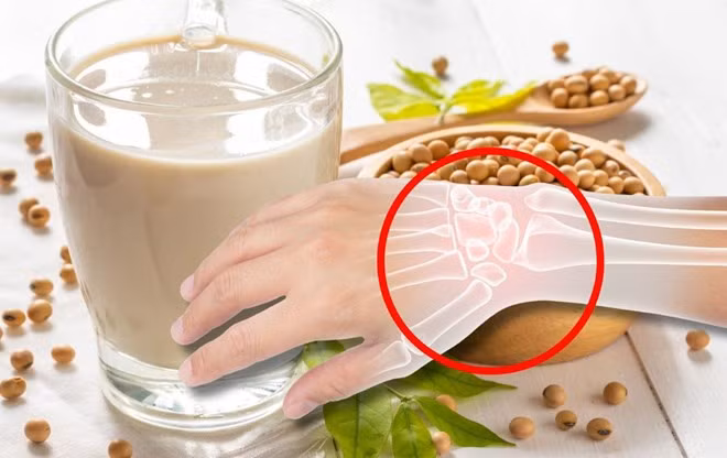 Sữa đậu nành giàu canxi tốt cho xương. Đồ họa: Thanh Thanh
